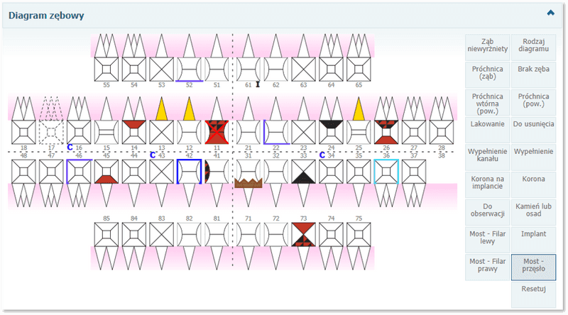 Sekcja: Diagram zębowy